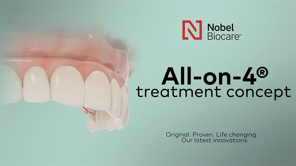All-on-4 treatment